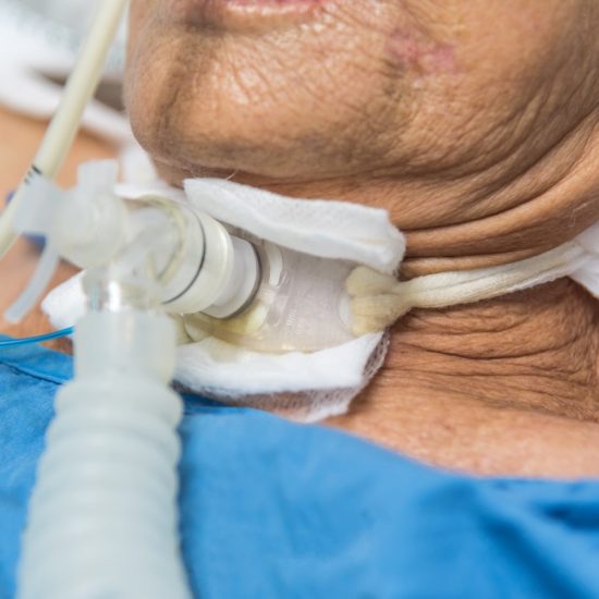 Patient asian elder women 80s do tracheostomy use ventilator for respiration breathing help on patient bed in intensive care unit (ICU.) room at hospital.